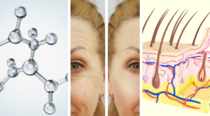 kollagén és a feszesbőr